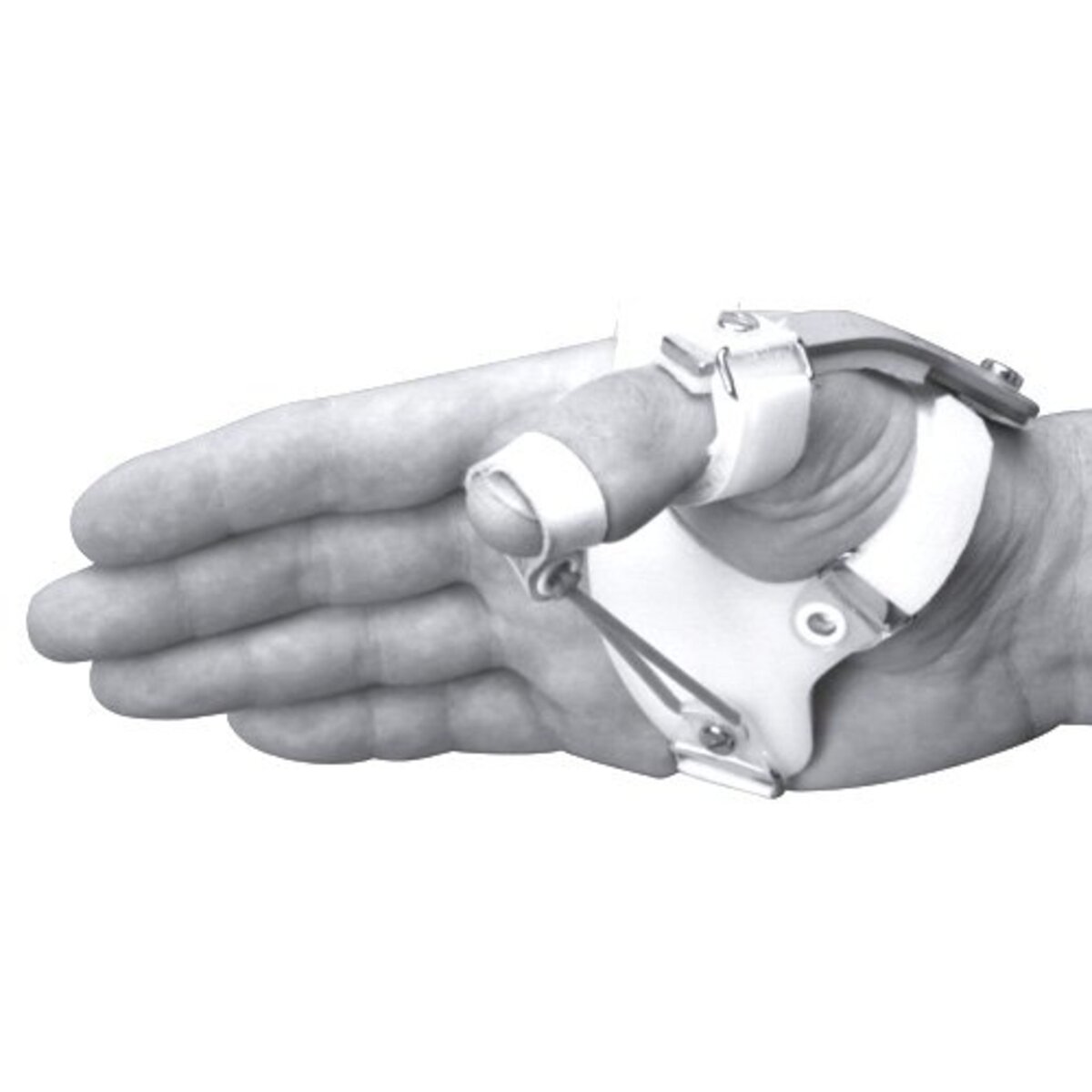 Mannerfelt Dynamic Thumb without Palmar